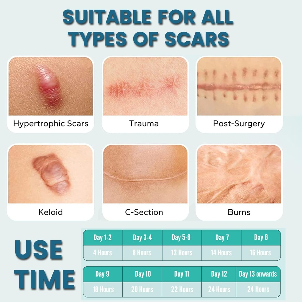 silicone-scar-sheets-2-rolls-medical-gra-5.jpg